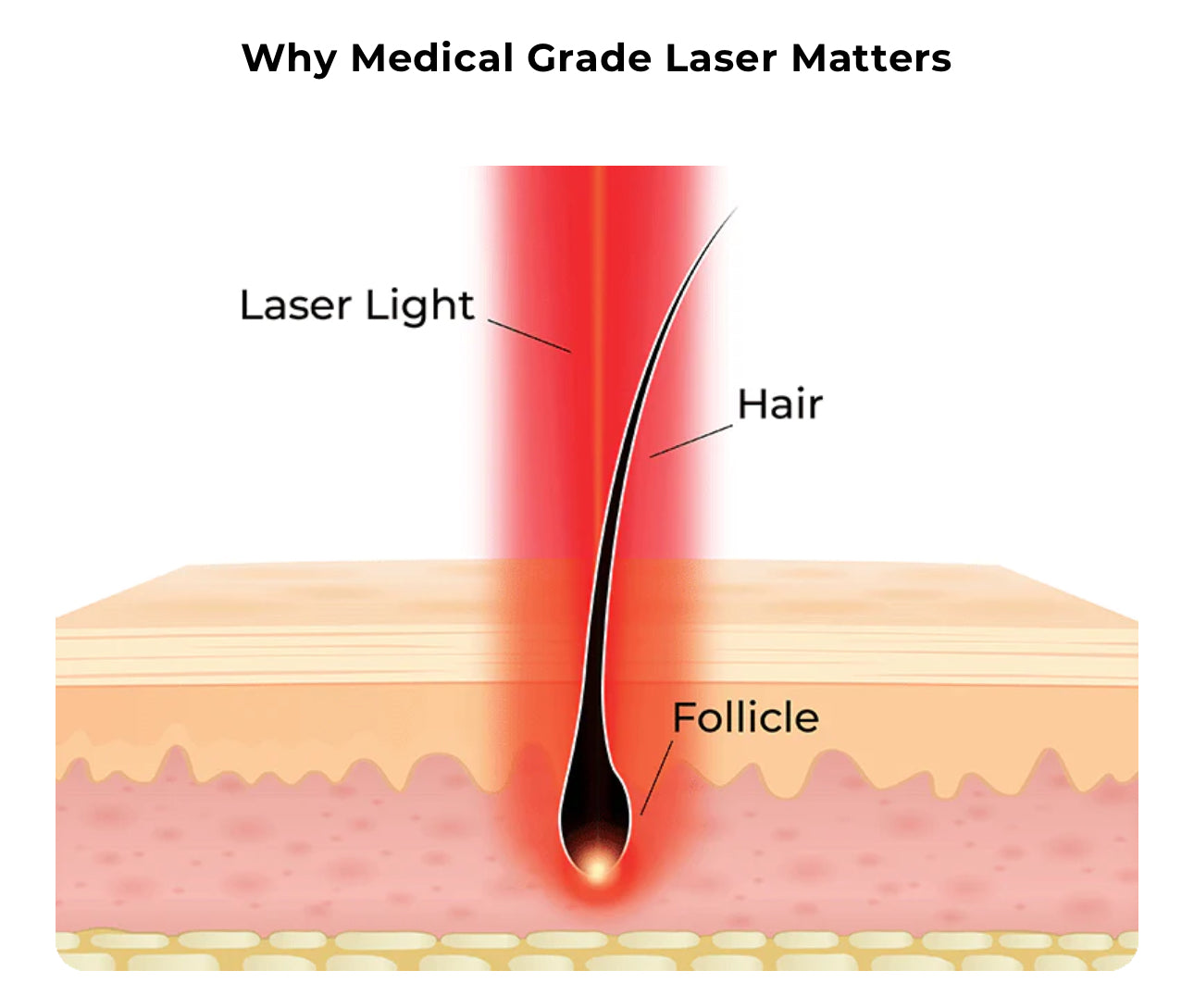 HairMax LaserBand 41 ComfortFlex Hair Growth Device