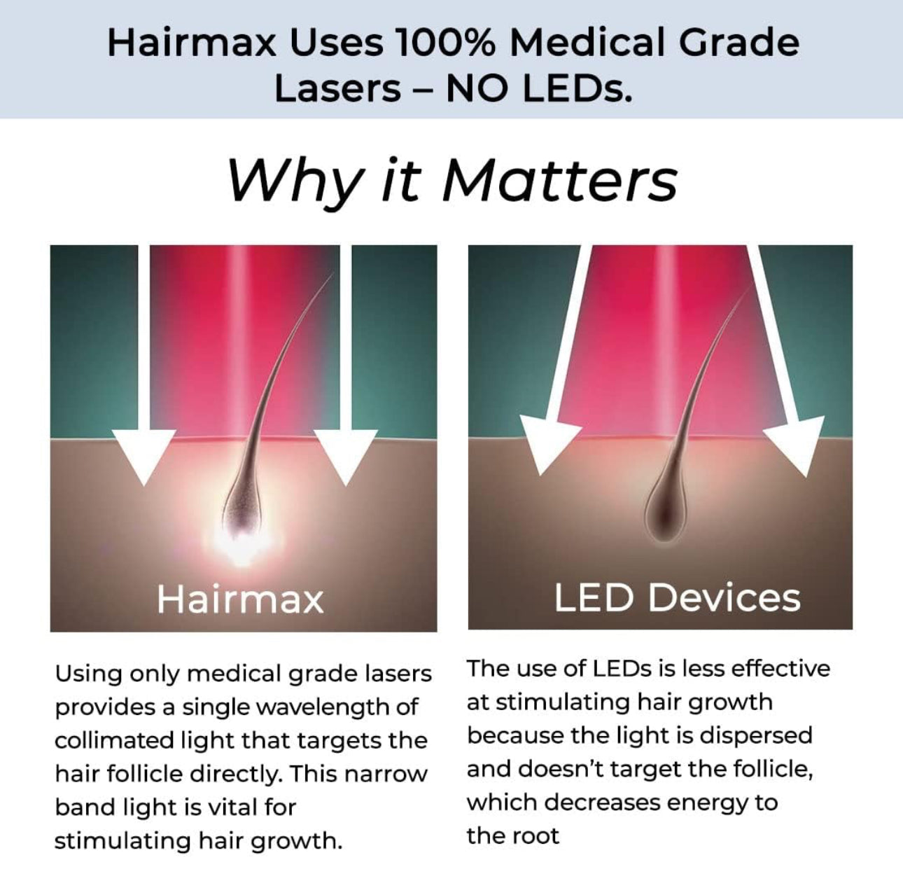 HairMax Regrow MD Laser Hair Growth Cap