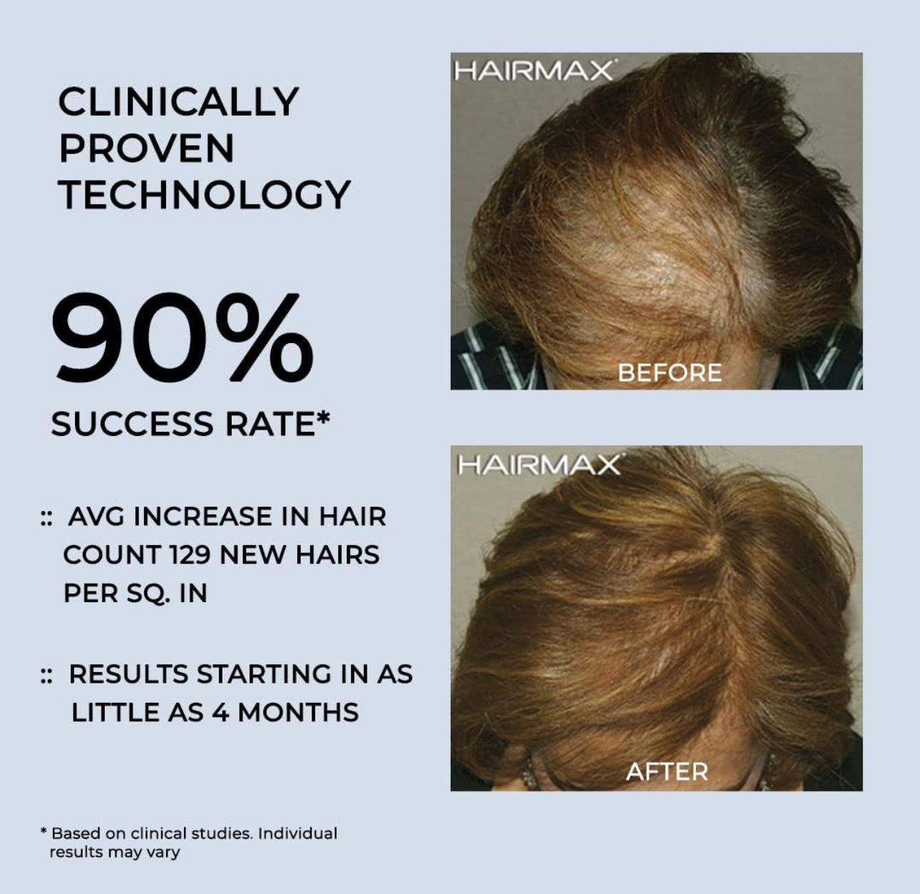 HairMax Regrow MD Laser Hair Growth Cap