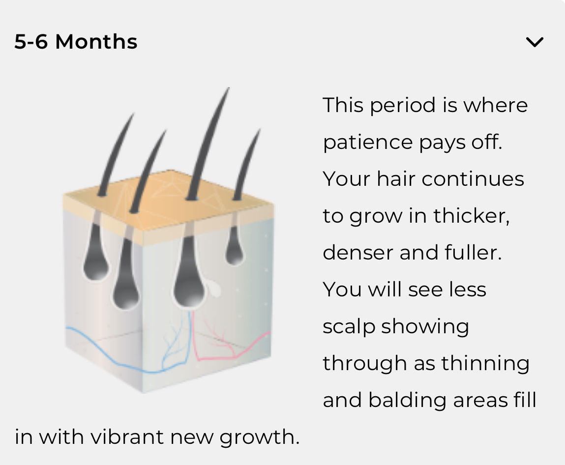 HairMax LaserBand 41 ComfortFlex Hair Growth Device